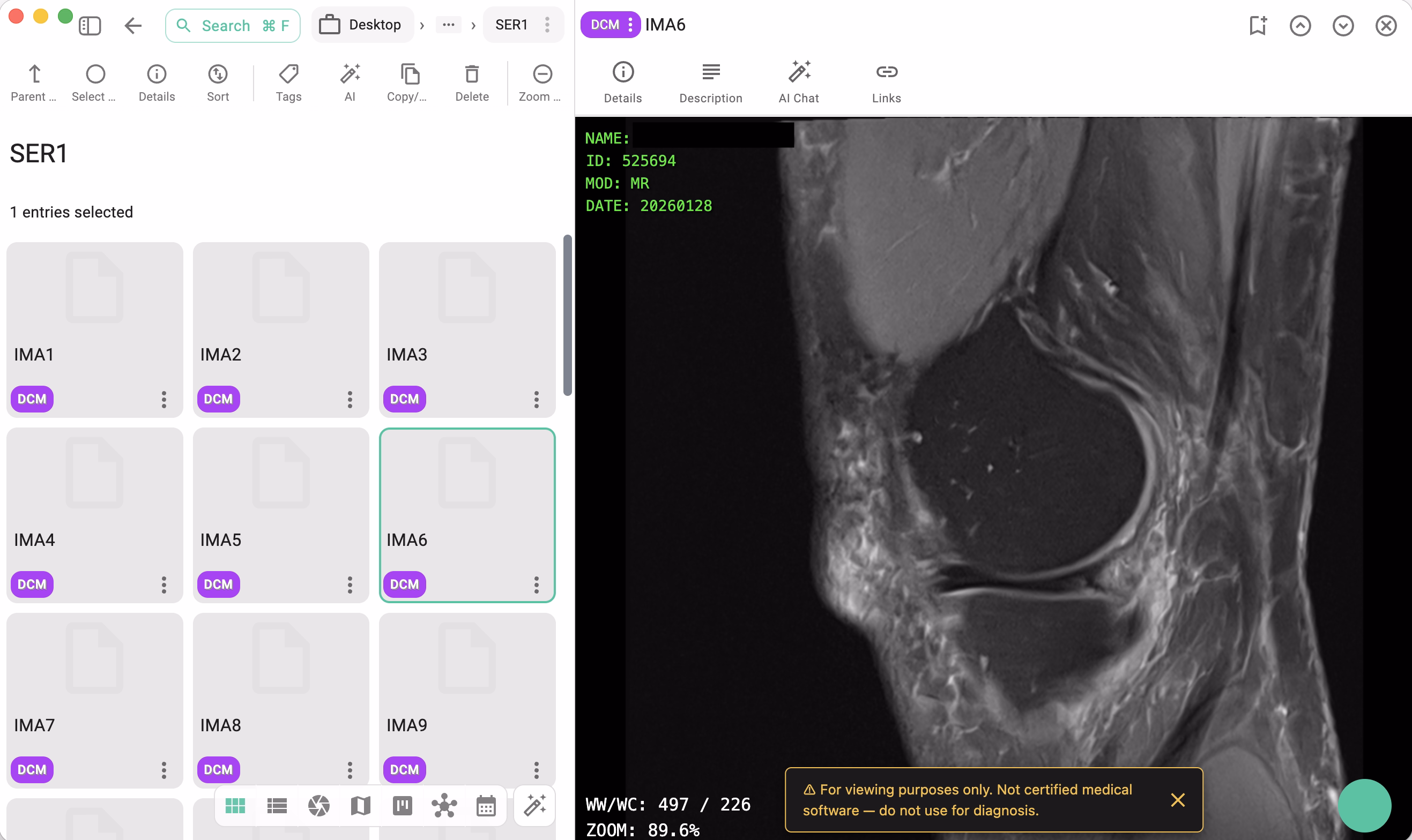 TagSpaces with integrated DICOM medical image viewer