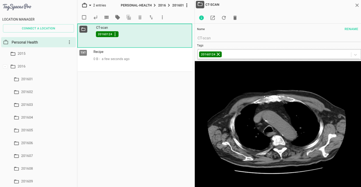 TagSpaces prototype with integrated viewer for DICOM medical images